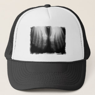 X-Ray Feet Human Skeleton Botten zwart-wit Trucker Pet