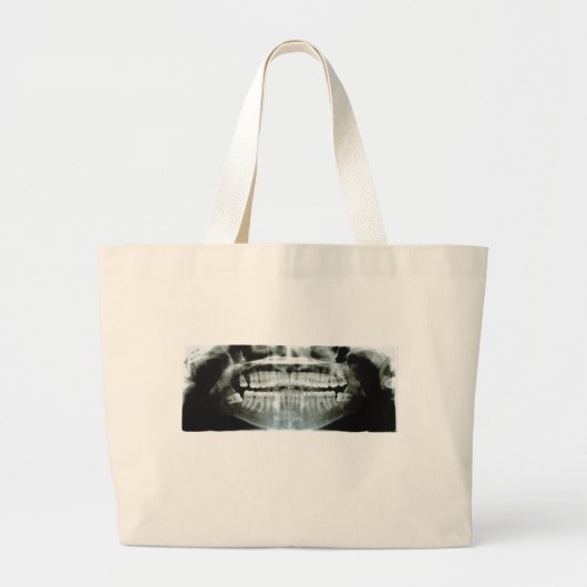 X-Ray Grote Tote Bag (Voorkant)