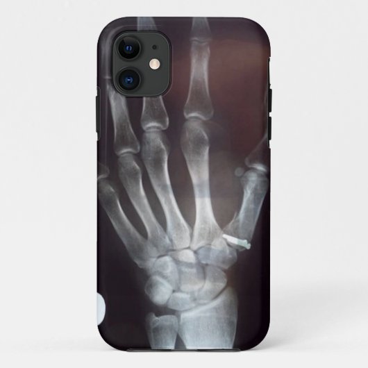 X Ray Hand Phone Case (Achterkant)