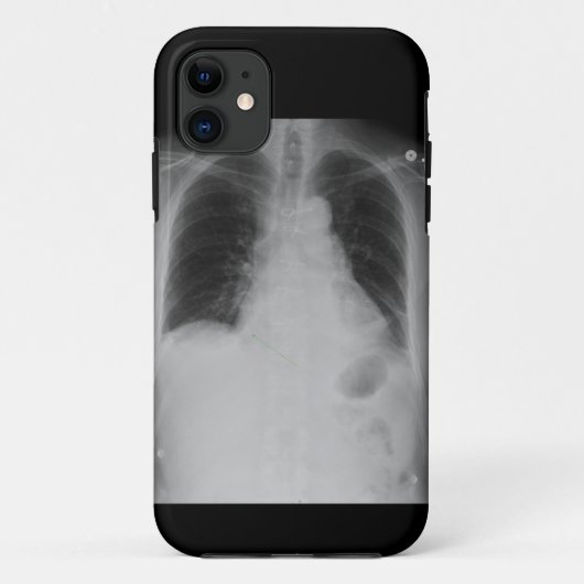 X Ray ~ iPhone 5 CaseMate-hoesje Case-Mate iPhone Case (Achterkant)