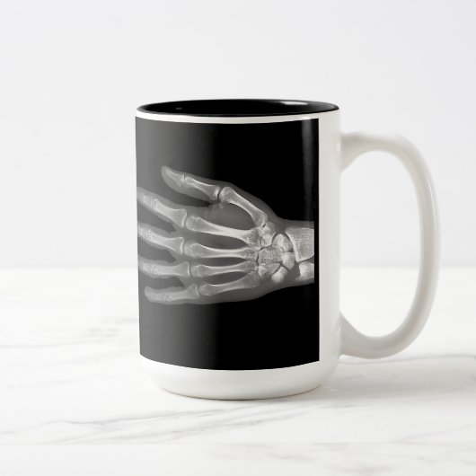 X-Ray-Mok met skelet Tweekleurige Koffiemok (Rechts)