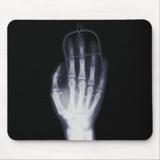 X-Ray Mousepad Muismat