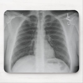 X-Ray Mousepad Muismat