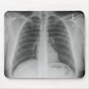 X-Ray Mousepad Muismat