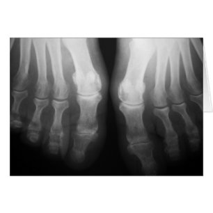 X-Ray Pieds humains Skeleton Bones noir et blanc