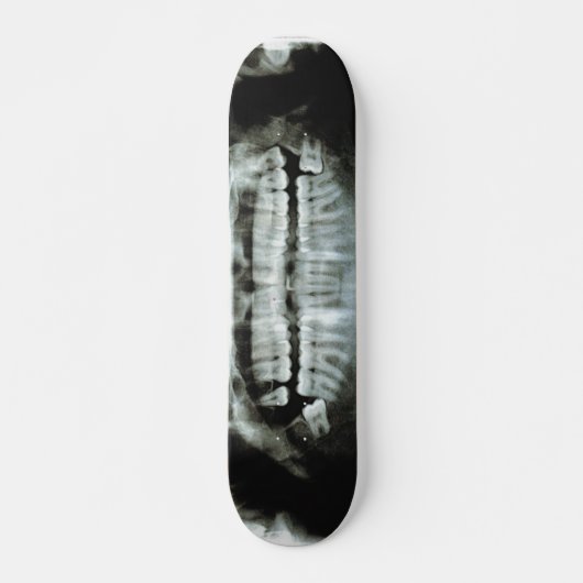 X-Ray Skateboard (Voorkant)