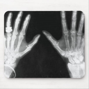 X-Ray Skelethandjes en juwelen - B&W Muismat