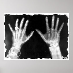 X-Ray Skelethandjes en juwelen - B&W Poster