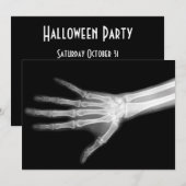 X-Ray Skeleton Arms Zwart-wit Kaart (Voorkant / Achterkant)