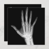 X-Ray Skeleton Arms Zwart-wit Kaart (Voorkant / Achterkant)