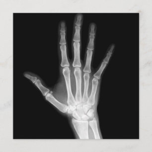 X-Ray Skeleton Arms Zwart-wit Kaart