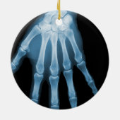 X-RAY SKELETON HAND FINGERS BLUE KERAMISCH ORNAMENT (Achterkant)