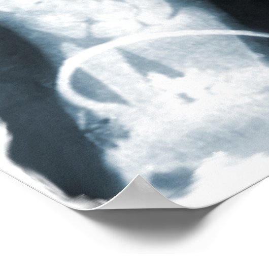 X-Ray Skeleton Hands & Juwelry - Blauw Poster (Hoek)