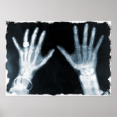 X-Ray Skeleton Hands & Juwelry - Blauw Poster (Voorkant)