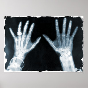 X-Ray Skeleton Hands & Juwelry - Blauw Poster