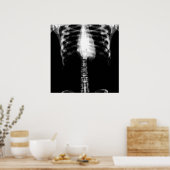 X-RAY SKELETON TORSO RIBS - B&W POSTER (Keuken)