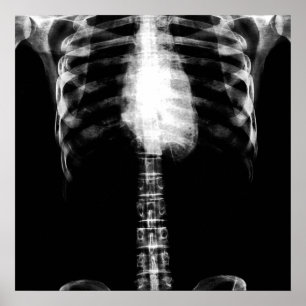 X-RAY SKELETON TORSO RIBS - B&W POSTER