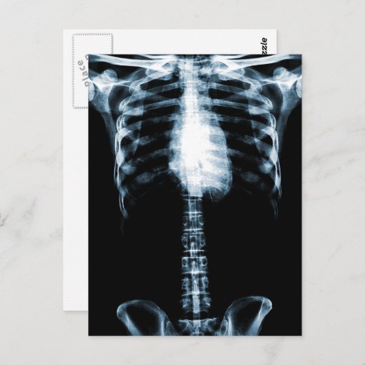 X-RAY SKELETON TORSO RIBS BLUE BRIEFKAART (Voorkant / Achterkant)