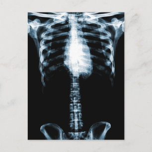 X-RAY SKELETON TORSO RIBS BLUE BRIEFKAART