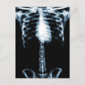 X-RAY SKELETON TORSO RIBS BLUE BRIEFKAART (Voorkant)