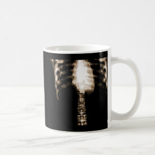 X-RAY SKELETON TORSO RIBS - SEPIA KOFFIEMOK