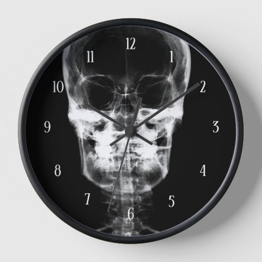 X-Ray Skull - B&W (Voorkant)