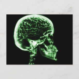 X-RAY SKULL BRAIN - GROEN BRIEFKAART