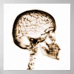 X-RAY SKULL BRAIN - ORANJE POSTER