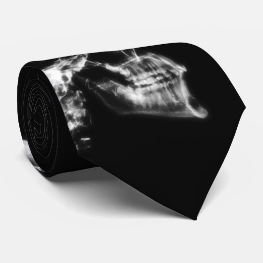 X-RAY SKULL BRAIN - ZWART EN WITTE STROPDAS (Opgerold)
