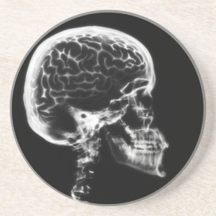 X-RAY SKULL BRAIN - ZWART EN WITTE ZANDSTEEN ONDERZETTER