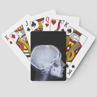 X-Ray-speelkaarten Pokerkaarten