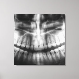 X-Ray Teeth Mouth Smile Black en White Canvas Afdruk