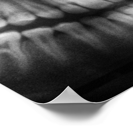 X-Ray Teeth Mouth Smile Black en White Poster (Hoek)