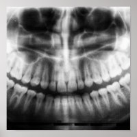 X-Ray Teeth Mouth Smile Black en White