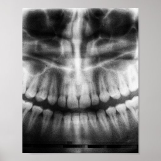 X-Ray Teeth Mouth Smile Black en White Poster (Voorkant)