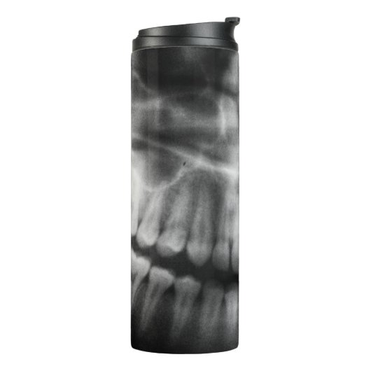 X-Ray Teeth Mouth Smile Black en White Thermosbeker (Gedraaid links)