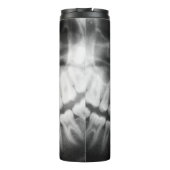 X-Ray Teeth Mouth Smile Black en White Thermosbeker (Achterkant)