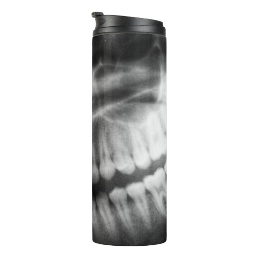 X-Ray Teeth Mouth Smile Black en White Thermosbeker (Geroteerd rechts)