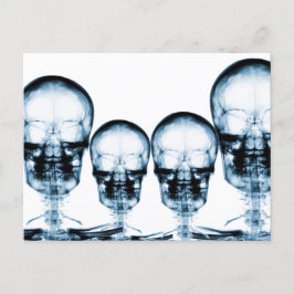 X-Ray Vision Skeleton Skull - Blue Briefkaart