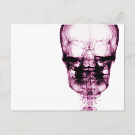 X-Ray Vision Skeleton Skull - Pink Briefkaart (Voorkant)