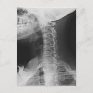 X-rayed 2 briefkaart