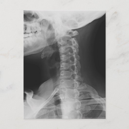 X-rayed 2 briefkaart (Voorkant)