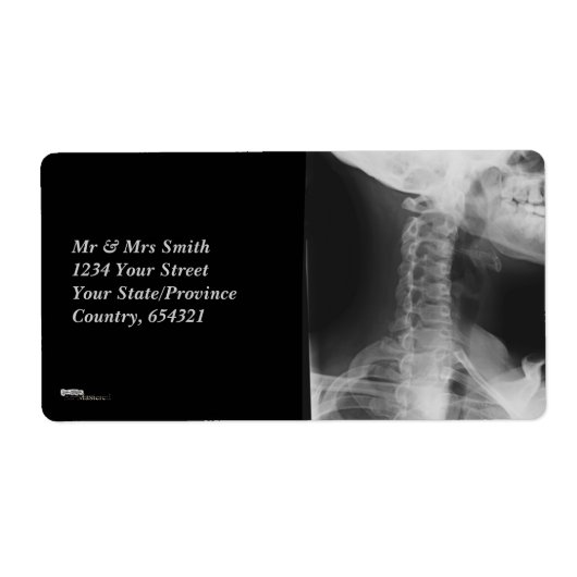 X-rayed 2 etiket (Voorkant)