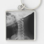 X-rayed 2 sleutelhanger (Voorkant)