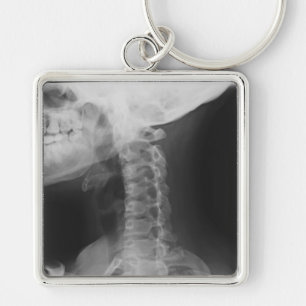 X-rayed 2 sleutelhanger