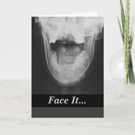 X-rayed 3 kaart (Voorkant)