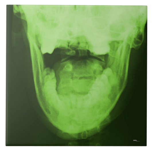 X-rayed 3 - Radioactive Green Tegeltje (Voorkant)