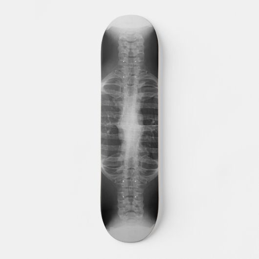 X-rayed 3 skateboard (Voorkant)
