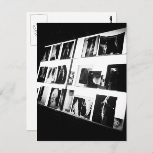 X-Rays Briefkaart (Voorkant / Achterkant)