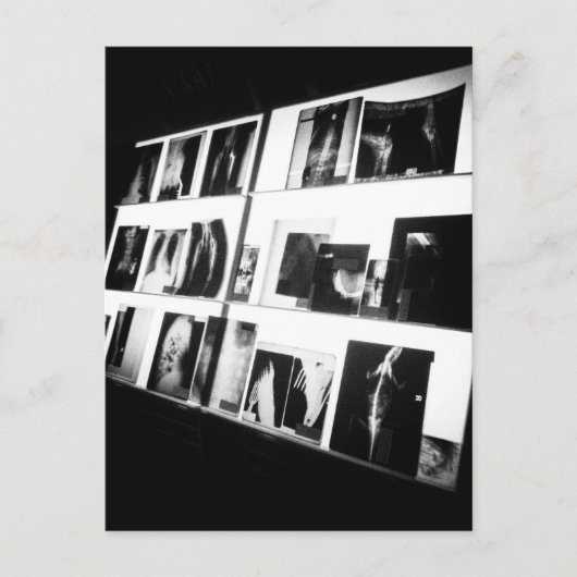 X-Rays Briefkaart (Voorkant)